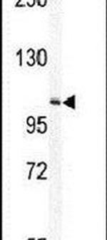 TECPR1 Antibody in Western Blot (WB)