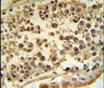 TCTN1 Antibody in Immunohistochemistry (IHC)