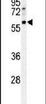 TCTN1 Antibody in Western Blot (WB)