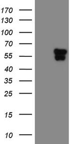 TEKT2 Antibody in Western Blot (WB)