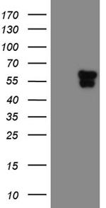 TEKT2 Antibody in Western Blot (WB)