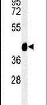 TEKT4 Antibody in Western Blot (WB)