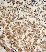 TERT Antibody in Immunohistochemistry (IHC)