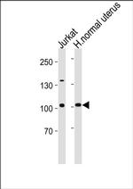 TERT Antibody in Western Blot (WB)