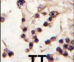 TESK2 Antibody in Immunohistochemistry (IHC)