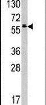 TESK2 Antibody in Western Blot (WB)