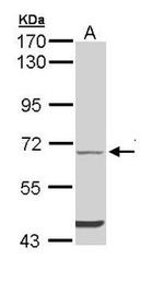 TESK2 Antibody in Western Blot (WB)