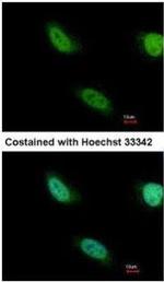 TET1 Antibody in Immunocytochemistry (ICC/IF)