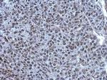 TET1 Antibody in Immunohistochemistry (Paraffin) (IHC (P))