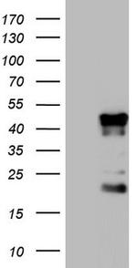 TET3 Antibody in Western Blot (WB)