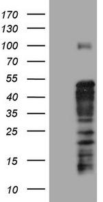 TET3 Antibody in Western Blot (WB)