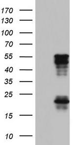 TET3 Antibody in Western Blot (WB)