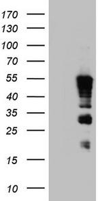 TET3 Antibody in Western Blot (WB)