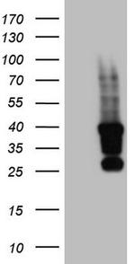 TET3 Antibody in Western Blot (WB)