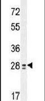 TEX13B Antibody in Western Blot (WB)