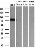TF Antibody in Western Blot (WB)