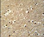 TFAP4 Antibody in Immunohistochemistry (IHC)