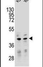 TFB2M Antibody in Western Blot (WB)