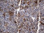 TFF1 Antibody in Immunohistochemistry (Paraffin) (IHC (P))