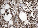 TFF1 Antibody in Immunohistochemistry (Paraffin) (IHC (P))