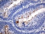 TFF1 Antibody in Immunohistochemistry (Paraffin) (IHC (P))