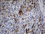TFF1 Antibody in Immunohistochemistry (Paraffin) (IHC (P))