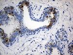 TFF1 Antibody in Immunohistochemistry (Paraffin) (IHC (P))