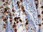TFF1 Antibody in Immunohistochemistry (Paraffin) (IHC (P))