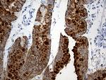 TFF1 Antibody in Immunohistochemistry (Paraffin) (IHC (P))