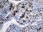 TFF1 Antibody in Immunohistochemistry (Paraffin) (IHC (P))