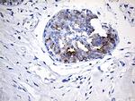 TFF1 Antibody in Immunohistochemistry (Paraffin) (IHC (P))