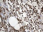 TFF1 Antibody in Immunohistochemistry (Paraffin) (IHC (P))