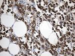 TFF1 Antibody in Immunohistochemistry (Paraffin) (IHC (P))