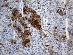 TFF1 Antibody in Immunohistochemistry (Paraffin) (IHC (P))