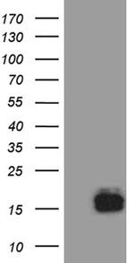 TFF3 Antibody in Western Blot (WB)