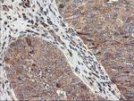 TFG Antibody in Immunohistochemistry (Paraffin) (IHC (P))