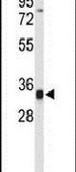 TFPT Antibody in Western Blot (WB)