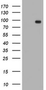 TFR2 Antibody in Western Blot (WB)