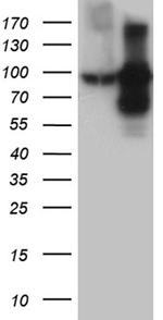 TFRC Antibody in Western Blot (WB)