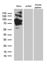 TFRC Antibody in Western Blot (WB)