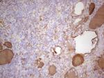 TG Antibody in Immunohistochemistry (Paraffin) (IHC (P))