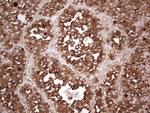 TG Antibody in Immunohistochemistry (Paraffin) (IHC (P))