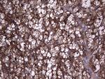 TG Antibody in Immunohistochemistry (Paraffin) (IHC (P))