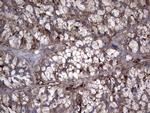TG Antibody in Immunohistochemistry (Paraffin) (IHC (P))