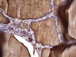 TG Antibody in Immunohistochemistry (Paraffin) (IHC (P))