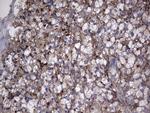 TG Antibody in Immunohistochemistry (Paraffin) (IHC (P))