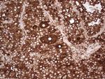 TG Antibody in Immunohistochemistry (Paraffin) (IHC (P))