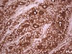 TG Antibody in Immunohistochemistry (Paraffin) (IHC (P))