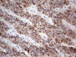 TG Antibody in Immunohistochemistry (Paraffin) (IHC (P))