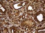 TG Antibody in Immunohistochemistry (Paraffin) (IHC (P))